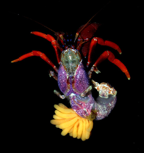 A Chilean hermit crab (Pagurus edwardsi) infested by a rhizocephalan (Peltogasterella gracilis)