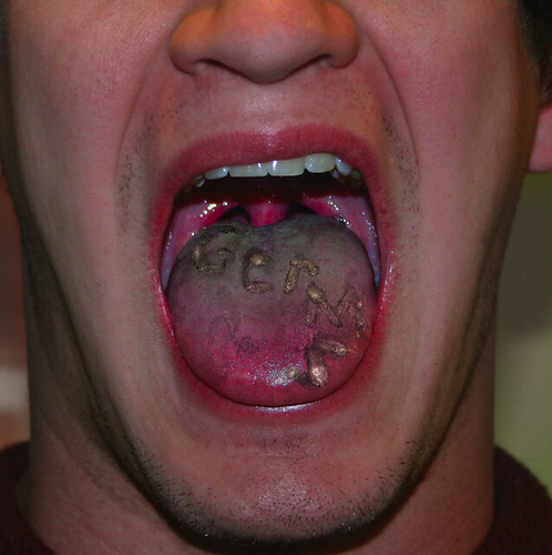 Pictures Of Mouth Bacteria 74