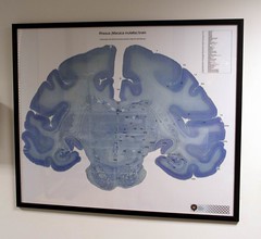 Brain poster