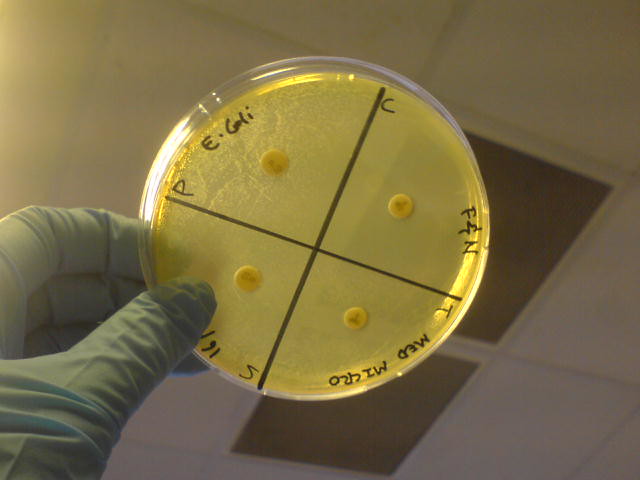 Antibiotic Resistance Program Wisconsin