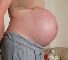 Programs For Pregnant Women 67