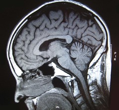 Brains (mine)