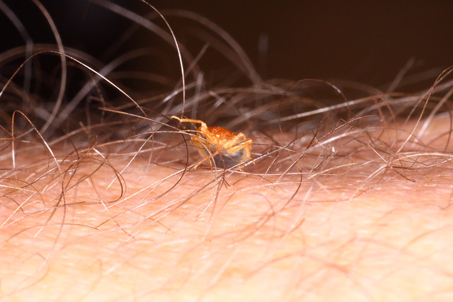 Bed Bugs and Hair | Flickr - Photo Sharing!