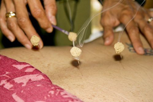 17.32_lede_Iao-Acupuncture_by-sean-hower
