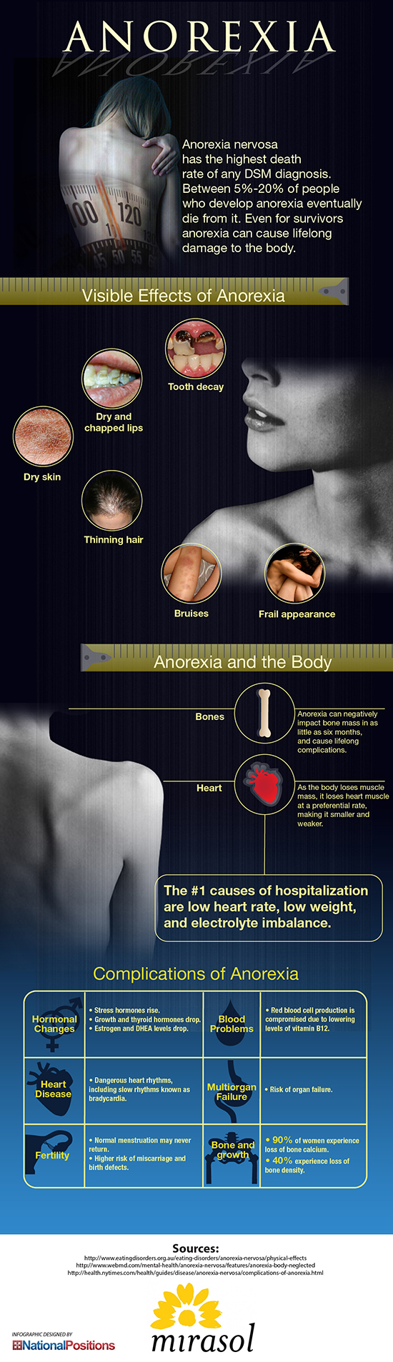 What are the symptoms of anorexia nervosa?