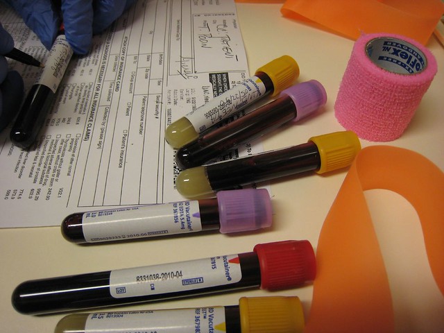 blood test cholesterol measurment