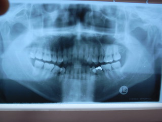 X-ray photograph