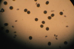 Roundworm and Hookworm eggs