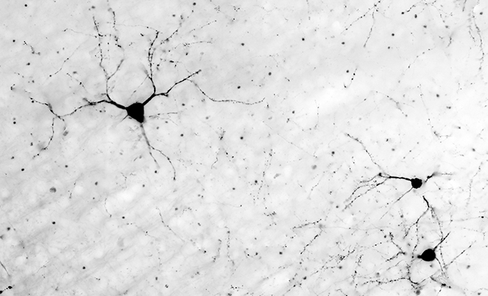 Neurons-in-the-brain