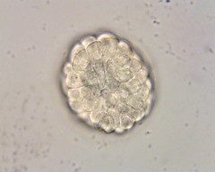  An early stage embryo consisting of cells (called blastomeres) in a solid ball contained within the zona pellucida. Distinct from a blastocyst in that it (3-4 days post fertilization) is an 8 cell mass in a spherical shape whereas a blas...