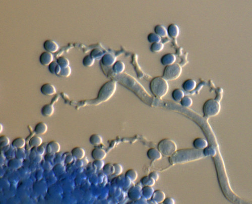 A high-magnification image of the spores and spore-bearing cells of the same fungus, Beauveria bassiana, taken from a Diabrotica beetle in Oregon.