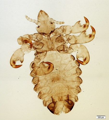 louse specimen, as viewed under microscope