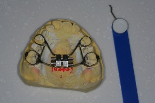黃經理牙醫診所 兒童牙醫-戽斗牙齒矯正6