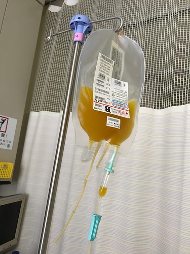 血小板の輸血